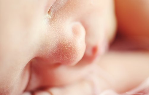 Sunkiai sergantis neišnešiotas naujagimis gelbėtas po gimimo neperspaudus virkštelės