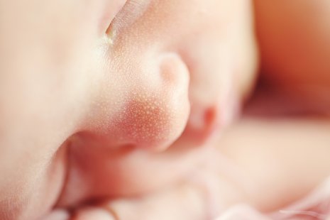 Sunkiai sergantis neišnešiotas naujagimis gelbėtas po gimimo neperspaudus virkštelės